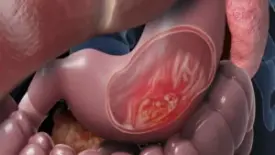 المعده والطحال