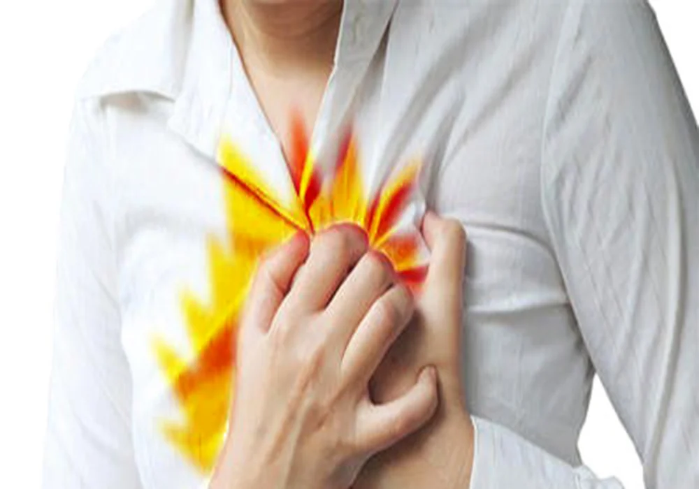 علاج ارتجاع المريء بالمنظار